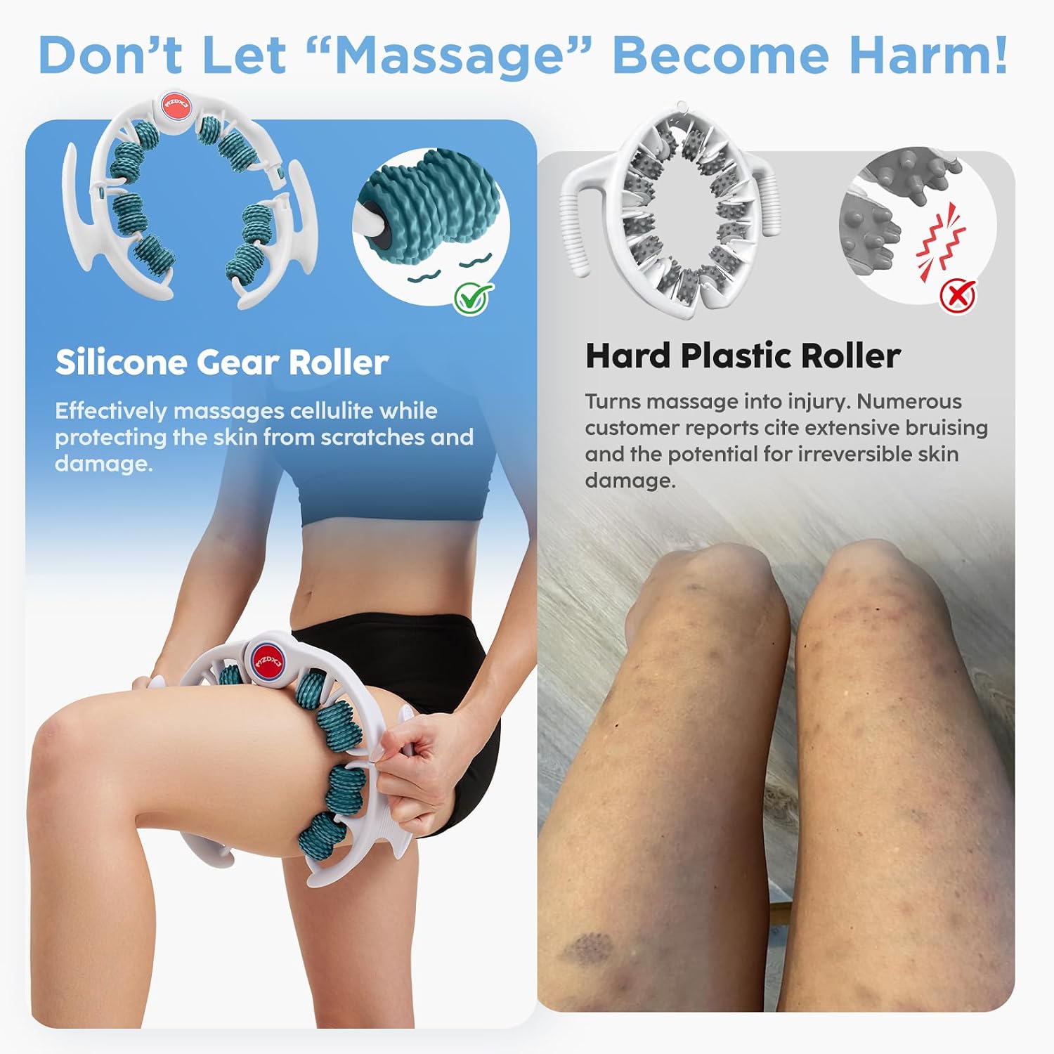 Cellulite Massage Tool - Lymphatic Drainage Massager - Muscle Roller, Deep Fascia Massage, Dimpled Skin Removal, Legs/Thighs/Buttocks, Anti-Cellulite Roller, Smooth Skin (14 Wheel - Green) - Image 3